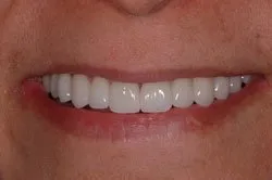 patient's smile after dental treatment