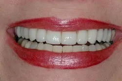 patient's smile after dental treatment