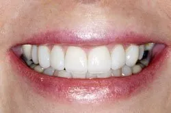 patient's smile after dental treatment