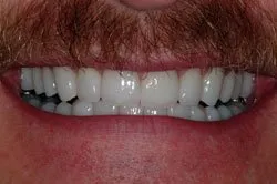 patient's smile after dental treatment