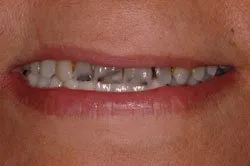 patient's smile before dental treatment