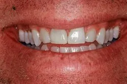 patient's smile before dental treatment