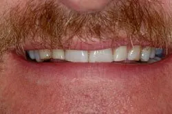 patient's smile before dental treatment