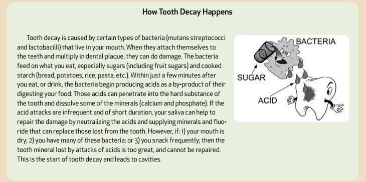 tooth decay infographic with information on what causes decay
