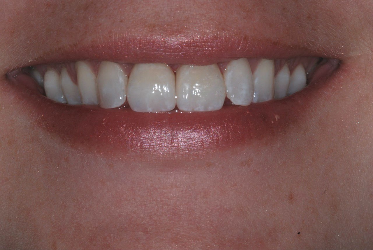 patient's smile after dental treatment