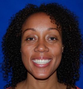patient smiling after successful treatment at Fountaingrove Dentistry