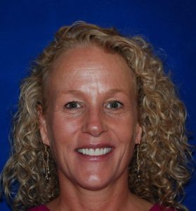 patient smiling after successful treatment at Fountaingrove Dentistry