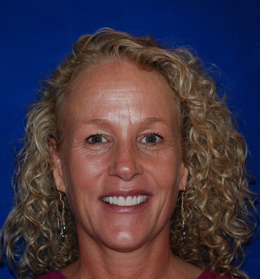 patient smiling after successful treatment at Fountaingrove Dentistry