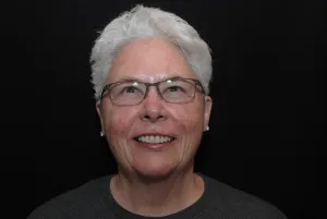 woman with straight teeth after Invisalign.