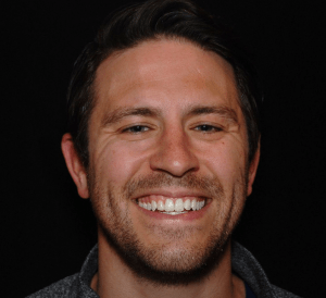 Man with straight teeth smiling after Invisalign treatment.