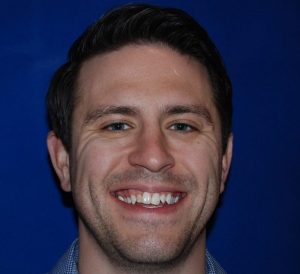Man smiling with crooked teeth before Invisalign treatment.