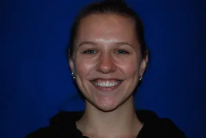 Female patient's smile before Invisalign
